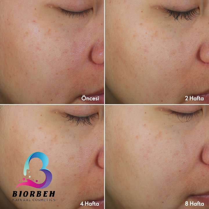 Comprehensive anti-pigmentation care Bright Intense 45595-4 پک مراقبتی روشن کننده پوست ارویفلیم 45595،پک مراقبت از پوست ارویفلیم 45595