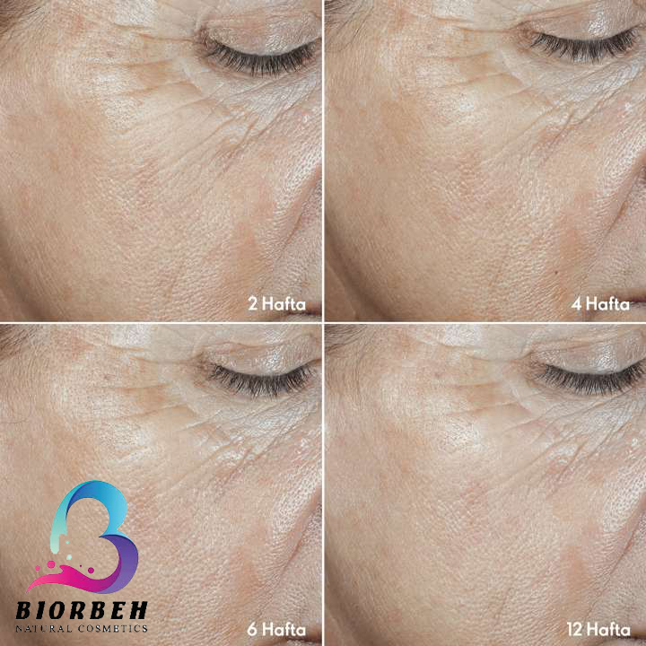 Comprehensive anti-wrinkle care Wrinkle Smooth 43695-3 پک جوانسازی و ضدچروک اوریفلیم 43695، ست مراقبتی نوایچ اوریفلیم 43695