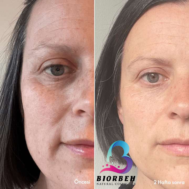 Comprehensive anti-wrinkle care Wrinkle Smooth 43695-5 پک مراقبتی جونساز نوایچ اوریفلیم 43695، ست مراقبتی ضد چروک نوایچ اوریفلیم 43695